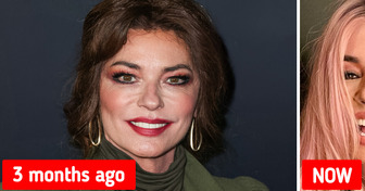 “That’s Not Even Her!” Shania Twain Shocks Fans With Her Unrecognizable Face