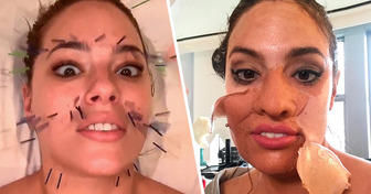 Ashley Graham Revealed Why She Needles Her Face and Butt Every Day