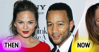 Chrissy Teigen's Powerful Response to People That Accused Her of Having "Too Much Filler"