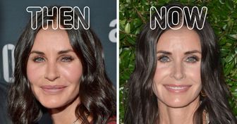 10 Celebs Share the Reasons Why They Said “No” to Cosmetic Surgery, Even Those Who Have Gone Under the Knife