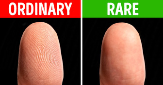 How People Without Fingerprints Live and Travel