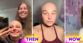 New Photo - A Man's Sweet Gesture for His Bald Girlfriend Took the Internet by Storm: Here's Their Story | 939TIKV | 2024-02-01 18:08:01