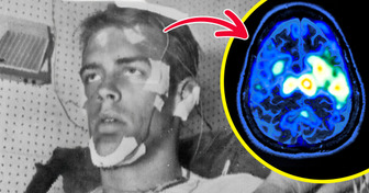 A Man, Who Didn’t Sleep for a Record 264 Hours as an Experiment, Suffered Crippling Long-Term Effect