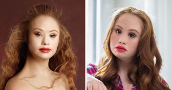 The Story of Madeline Stuart, a Supermodel With Down Syndrome and Autism, Who’s Thriving and Hasn’t Stopped Conquering New Heights