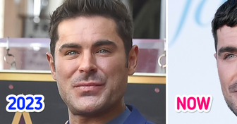 “He Got the Fillers Dissolved,” Zac Efron’s Latest Appearance Creates Stir