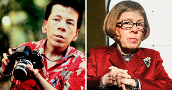An Unknown Story of Linda Hunt, a Woman Who Turned Her Disability Into Success