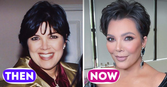 13 Celebrities’ Truly Honest Opinion About Their Own Plastic Surgeries