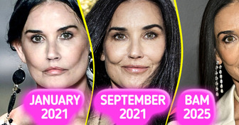 Experts Uncover What Really Changed Demi Moore’s Face