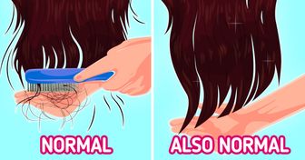 Causes of Hair Loss, and 7 Ways to Tell If You’re Losing Too Much of It