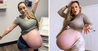 “Yes, I’m huge, and it’s hard!” A Woman Responds to Hurtful Comments She Unexpectedly Received While Pregnant