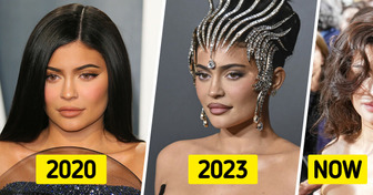 Why Kylie Jenner Suddenly Started to Look Different