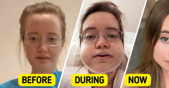 Singer Travels 24 Hours for Jaw Surgery, Shares Shocking Transformation