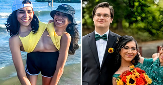 One of the Conjoined Twins Gets Married, People Say the Same Thing