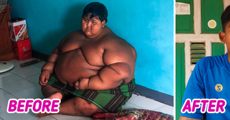 A Boy Who Was The World’s Heaviest Kid Shows How One Decision Can Change Your Whole Life