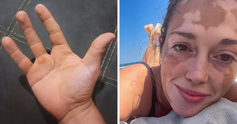 18 People Who Will Reboot Our Perception of Body Standards