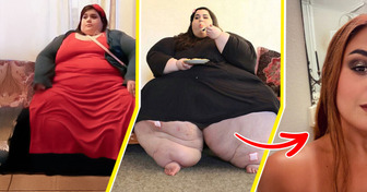 “My 600-lb Life” Star Amber Rachdi Stuns With 377-Lb Weight Loss, Becomes a Living Legend