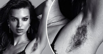 15 Famous Women Who Aren’t Bothered by a Bit of Body Hair
