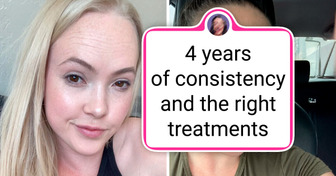 14 People Who Completely Reinvented Themselves