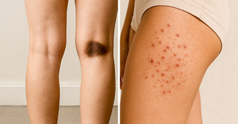 6 Alarming Signs You Might Be Experiencing Skin Burnout, and What They Mean