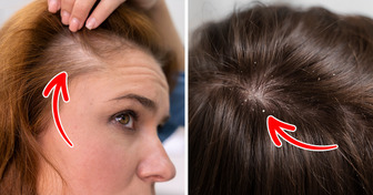 7 Health Signs Your Hair Might Reveal About Your Health