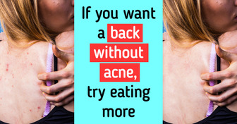 10 Tips to Get Rid of Body Acne and Bring Back Your Confidence