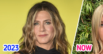 What Happened to Jennifer Aniston's Face, According to a Doctor