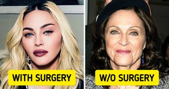 What 10 Famous People Might Look Like If They Had Let Nature Take Its Course
