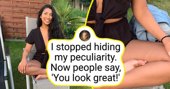 13 Times When Nature Gave People Unique Features
