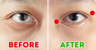 A 1-Minute Japanese Exercise to Remove Wrinkles Around the Eyes