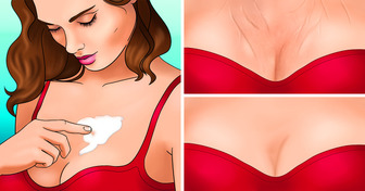 7 Easy Ways to Erase Your Chest Wrinkles
