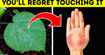 Unforgiving Plant Whose Sting Lasts for Years