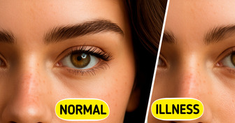 10 Hidden Signals Your Thyroid Is Not Functioning Properly