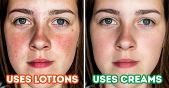 10 Tips for How to Deal With Red, Irritated Skin