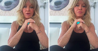 Goldie Hawn’s Skin Gets Internet Users Concerned