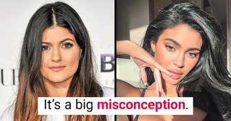 Kylie Jenner Shuts Down Rumors That She’s Had Too Much Surgery on Her Face