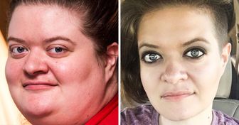 20+ People Who Were Tired of Carrying Extra Pounds and Now It’s Hard to Recognize Them