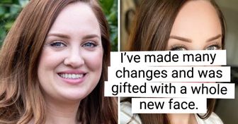20 Before and After Pics That Say: Don’t Wait Till New Year, Act Now