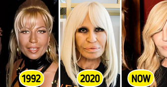 “Forever Young”, Donatella Versace’s Drastic Transformation Leaves Fans Stunned