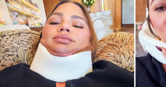 Chrissy Teigen Reveals Horror Injury as She Misses Out on the 2024 Met Gala