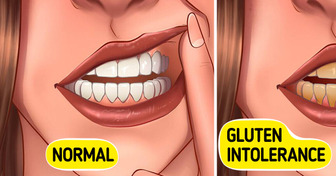 11 Gluten Intolerance Signs People Tend to Overlook