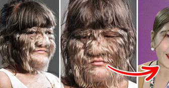 The World’s Hairiest Girl Is Completely Shaved, and She Looks Unrecognizable Now