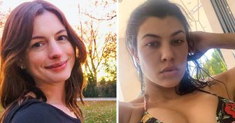 Celebrities Showed Their Faces in a #Nomakeup Challenge, and We Admire Them for It