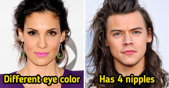 10 Celebrities With Special Features That Actually Make Them One of a Kind