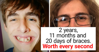 15+ Before and After Photos That Show the Power of Time