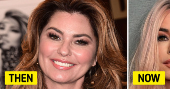 Shania Twain Deemed Unrecognizable After Her Face Shocked People in New Photos