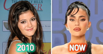 Kylie Jenner Claims She “Has Never Had a Plastic Surgery” And Explains Her Drastic Appearance Change