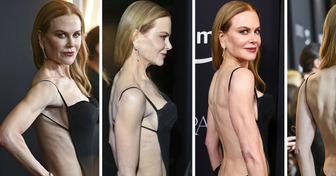 Nicole Kidman’s Revealing Dress Sparks a Heated Discussion