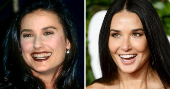 15 Stars Who Prove That a New Smile Can Totally Transform the Way We Look