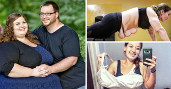 Couple Pledged to Lose Weight, And Their Extreme Result Stunned Everyone