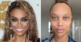 15 Celebrities Who Prove You Don’t Need Makeup to Feel Beautiful